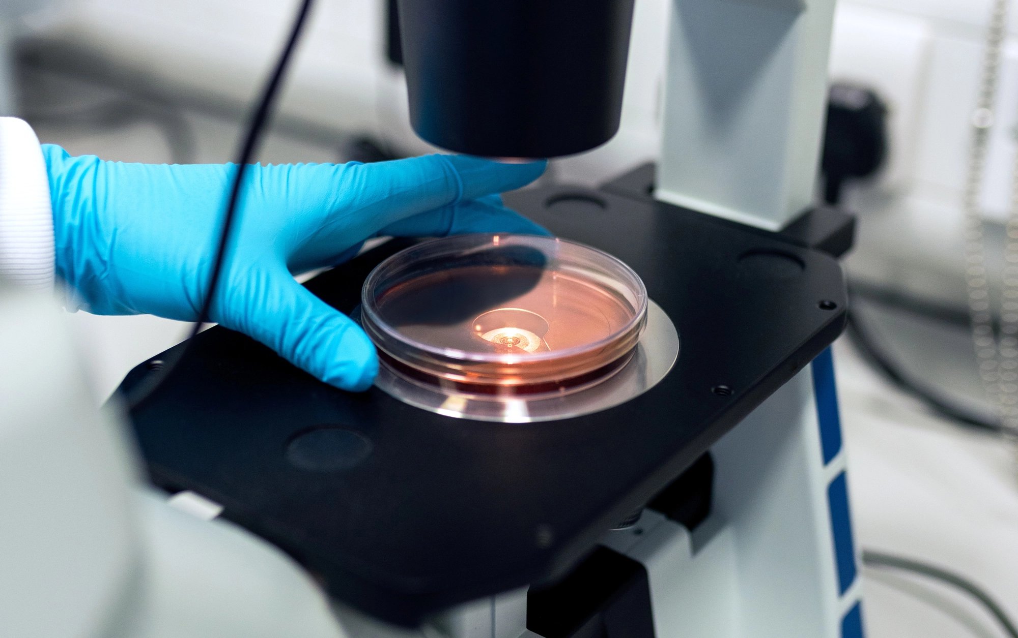 scientist observing cell culture dish under microscope