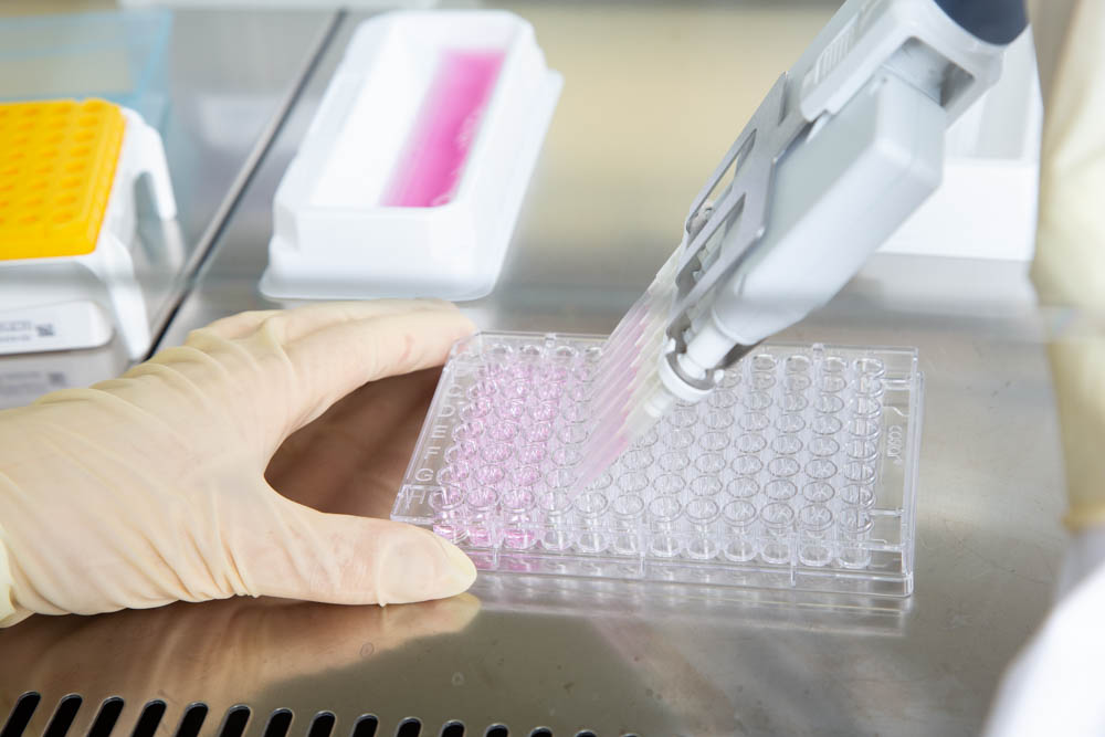 Cells being distributed in laboratory for analysis.